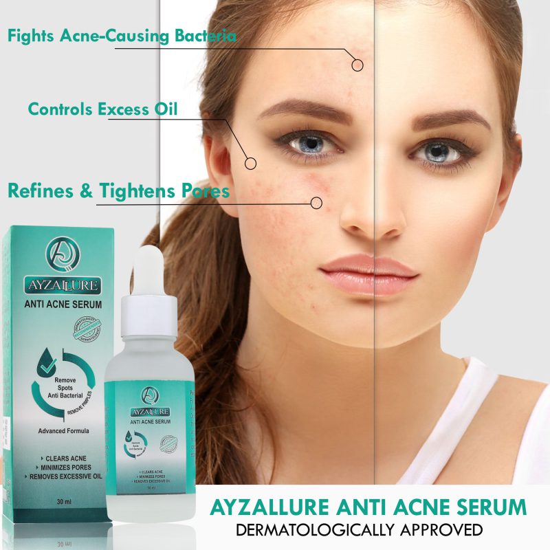 Anti-Acne Serum 30ml - Image 3